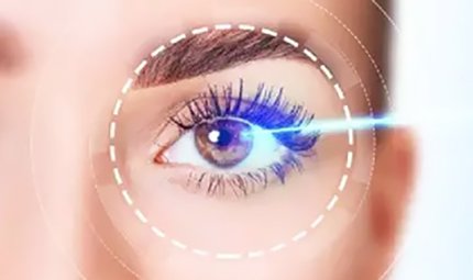 Lazerle Göz Rengi  Açtırma